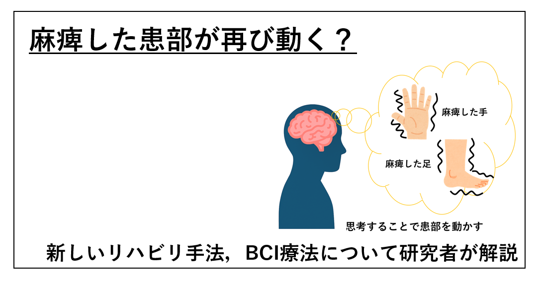 BCI療法に関する記事のアイキャッチ画像