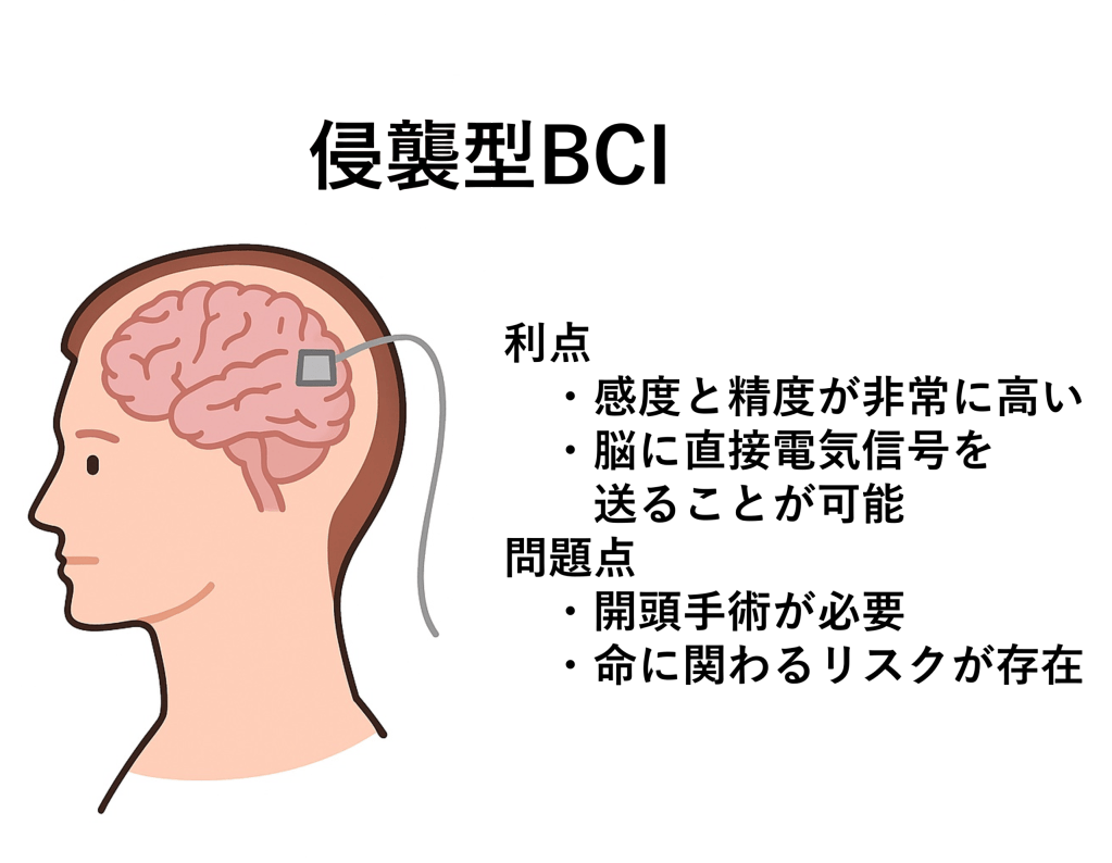 侵襲型BCIについての解説図